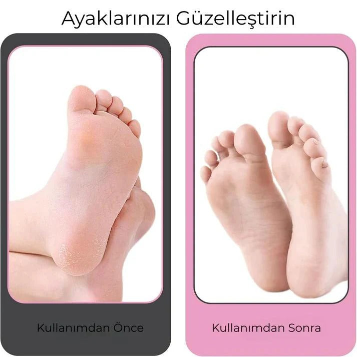 PediLüks Pro – Elektrikli Topuk Törpüsü | Evde Spa Kalitesinde Pedikür
