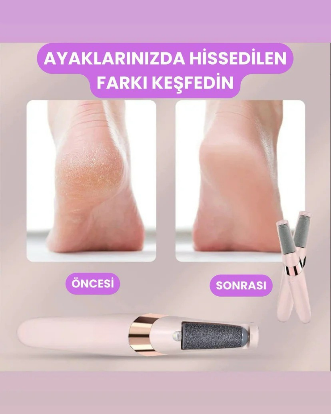 PediLüks Pro – Elektrikli Topuk Törpüsü | Evde Spa Kalitesinde Pedikür
