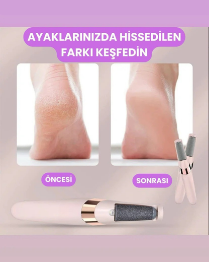 PediLüks Pro – Elektrikli Topuk Törpüsü | Evde Spa Kalitesinde Pedikür
