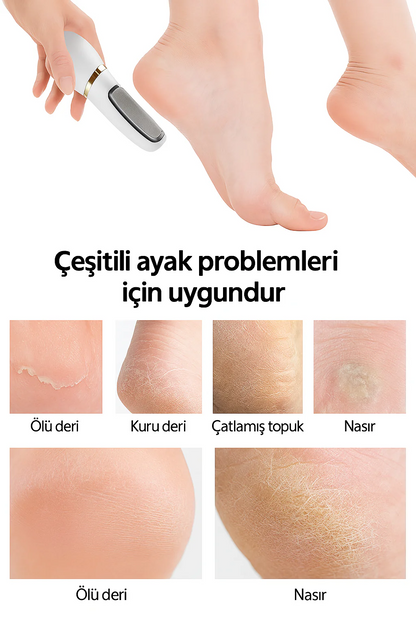 PediLüks Pro – Elektrikli Topuk Törpüsü | Evde Spa Kalitesinde Pedikür